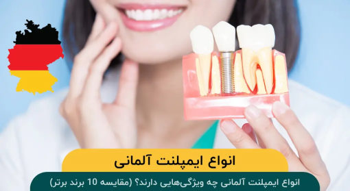 ایمپلنت-آلمانی